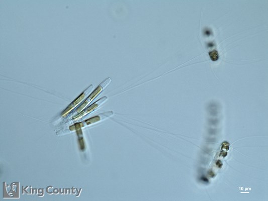 Photo of Pseudo-nitzschia americana